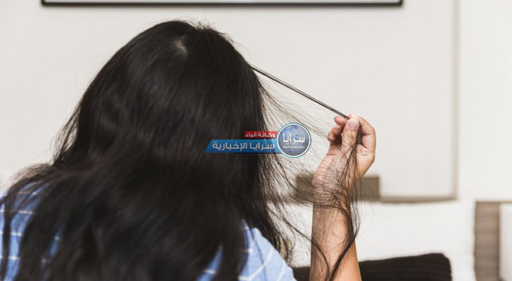 مرض غريب يؤدي لفقدان شعر الرأس