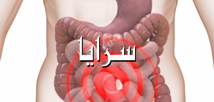 تعرف على أفضل طريقة لتنظيف القولون في المنزل!