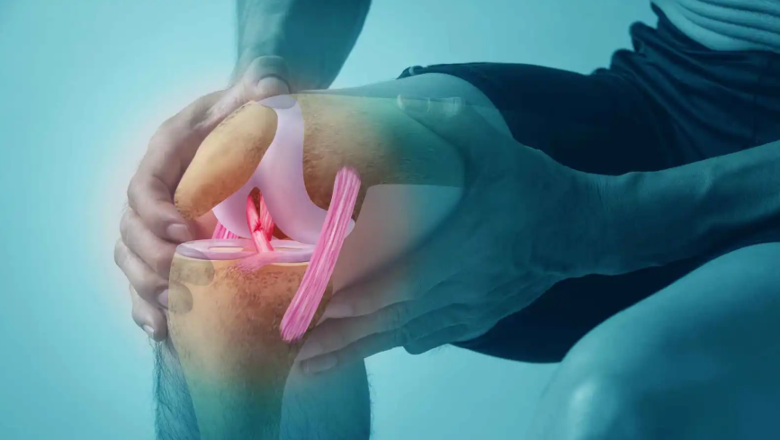 أدوية فقدان الوزن قد تعكس التهاب المفاصل الأكثر شيوعًا