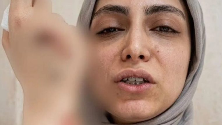 كسر مضاعف وجراحة ..  اعتداء على طبيبة أسنان يهز الأوساط الطبية في مصر