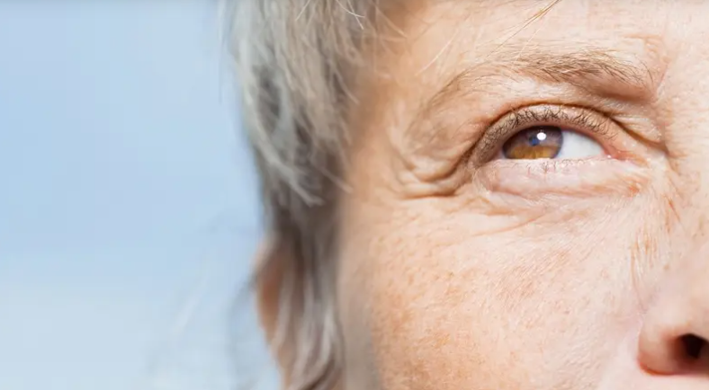 علامة في عينيك قد تنذر بنوبة قلبية ..  بقع صفراء تكشف خطرًا صامتًا