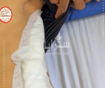 "كان يحتفل بعيد الاستقلال" ..  فتى يتعرض لهجوم عنيف من 7 ملثمين في إربد ويتلقى 60 غرزة لإغلاق جروحه