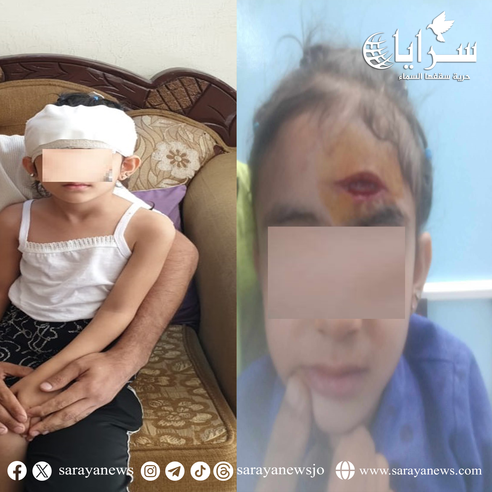 إصابة طالبة بجروح بعد سقوط مروحة على رأسها في إربد - صور 