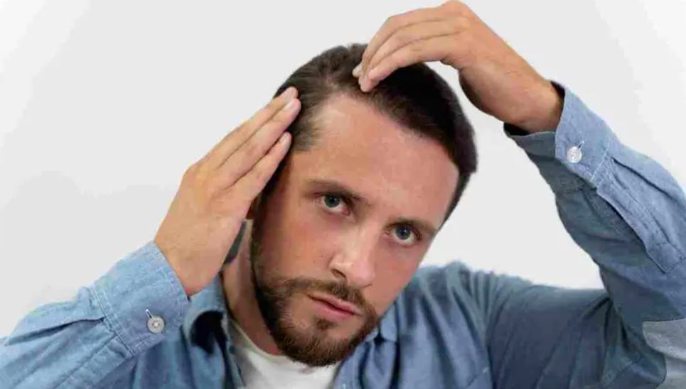 جفاف الفروة والقشرة ..  مشكلتان مختلفتان يعاني منهما الرجال