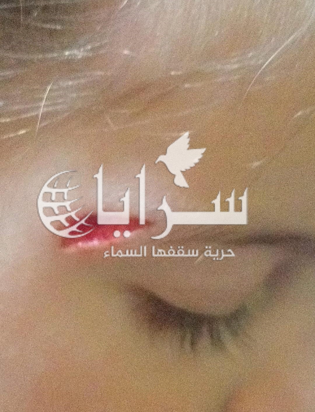 عجز مركز صحي وادي موسى الشامل عن تقطيب جرح طفلة يثير حفيظة والدها ..  صورة 