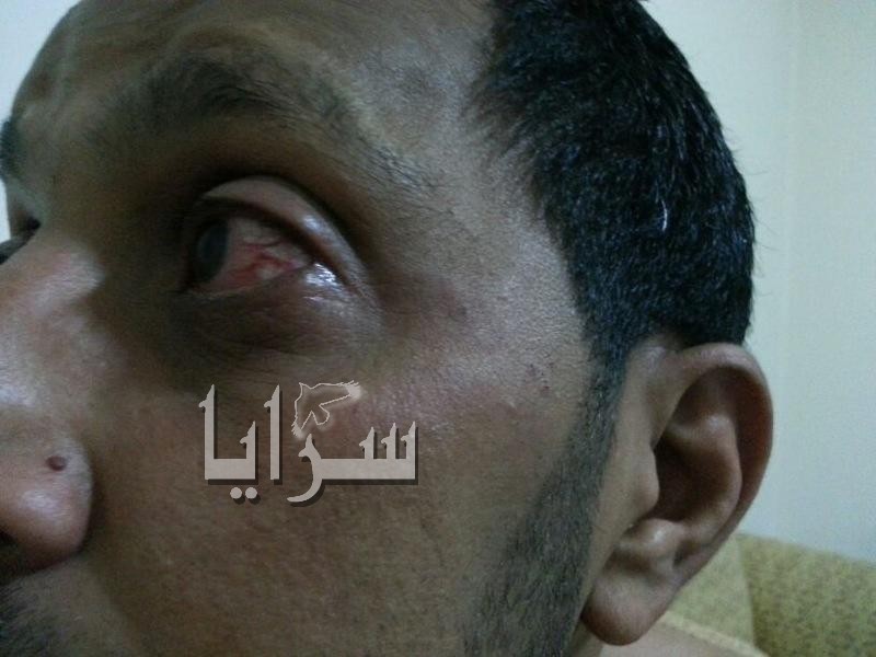 مواطن أردني تعرض للضرب في لبنان والسفارة الاردنية ترد "دبر حالك" 