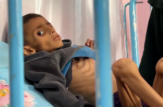 الجحيم ..  هذا ما يواجهه أطفال غزة