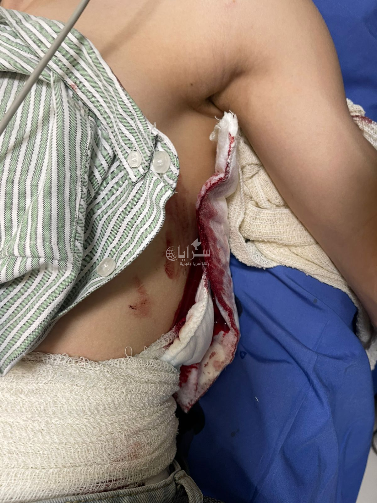 مجهول يعتدي بآلة حادة على فتى أمام مدينة الحسن الرياضية في إربد