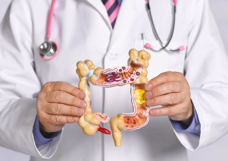   لم يعد حكرًا على كبار السن ..  سرطان القولون يهدد الشباب 