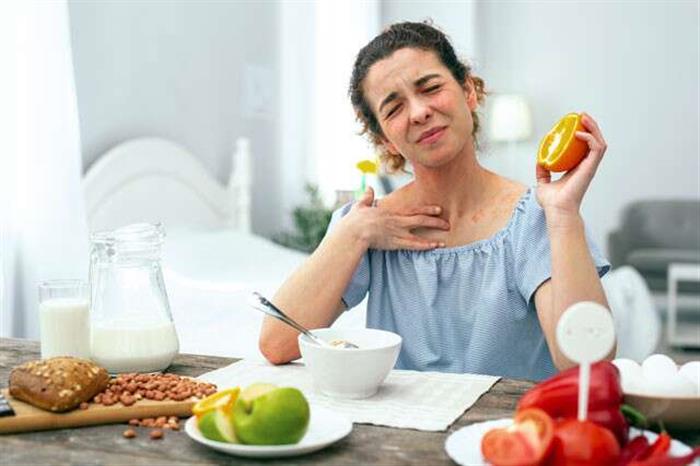 معلومات تهمك ..  كل ما تريد معرفته عن حساسية الطعام