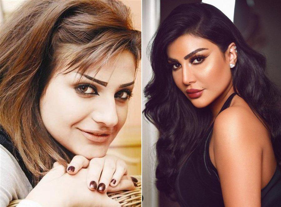 النجمات قبل وبعد عملية تجميل الأنف - صور | فن | وكالة ...