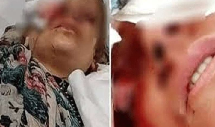 المؤبد لأردني "فقأ عيني زوجته" أمام أطفالها الثلاثة  ..  تفاصيل