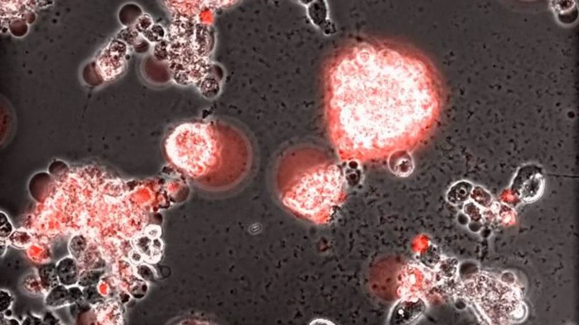 فيديو مذهل ..  هكذا يغزو فيروس كورونا خلايا الدماغ