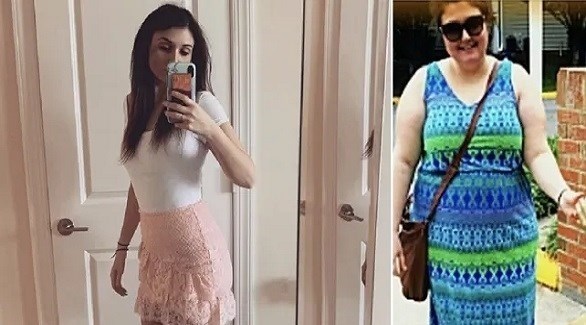تخسر 50 كيلو من وزنها وتصبح عارضة أزياء