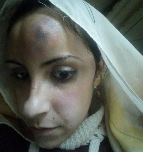 بالصور .. أسرة مصرية تبرح طليقة ابنهم ضرباً ..  والسبب لا يصدّق