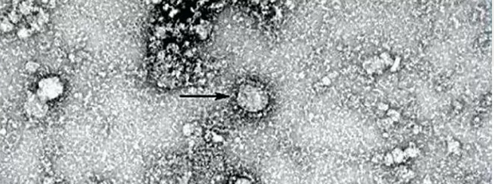 دراسة تقلب الموازين حول منشأ فيروس كورونا وتبرئ الصين