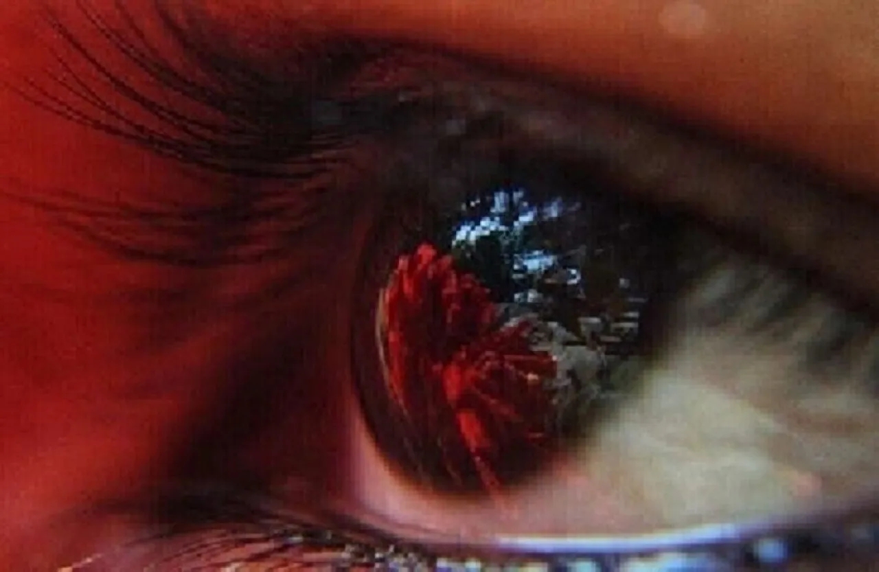 تقنية جديدة قد تنقذ الملايين من العمى