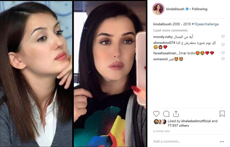 بالصور .. تحدّي الـ 10 سنوات ..  النجمات يرفعن شعار "كل ما تكبر تحلى"