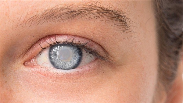 عائلة أردنية تناشد أهل الخير لإنقاذ ابنتهم التي قد تفقد بصرها - تفاصيل