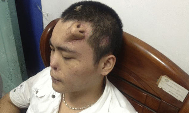 صورة مرعبة أنف لصيني في جبهته