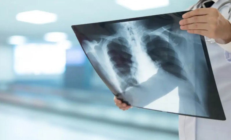 تحذير طبي مهم للمتعافين من "كوفيد-19"