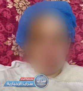 تفاصيل مؤثرة ترويها سيدة الرمثا ..  "إسلام" سحبها زوجها من شعرها أمام أطفالها و حرقها بالزيت المغلي 
