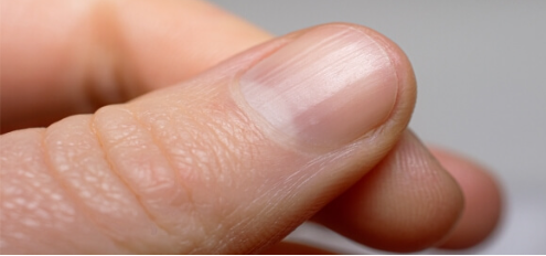 علامات تشير إلى نقص العناصر الدقيقة في الجسم