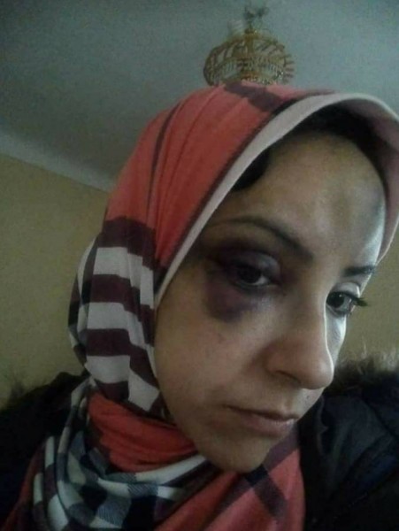  فتاة تتعرض للضرب المبرح على يد اهل زوجها لسبب صادم  ..  صور
