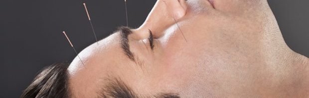 فوائد الإبر الصينية لعلاج الصداع