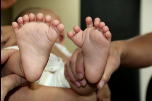 بالصور  ..  حالة نادرة : طفل يولد بـ(31) إصبعاً