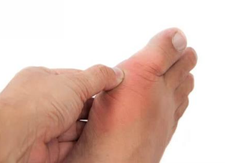 طبيب يوضح سبب تورم إبهام القدم