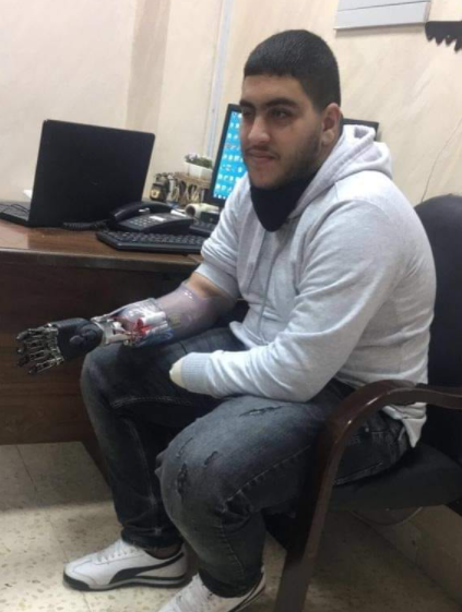 فيديو مؤثر :"فتى الزرقاء" صالح يتدرب على استخدام الأطراف الصناعية بعد الجريمة "البشعة" بحقه