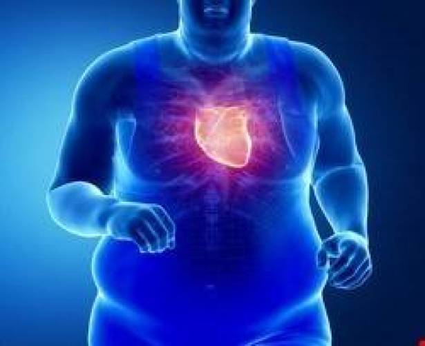 زيادة وزنك تعرّضك لمخاطر عدم انتظام ضربات قلبك