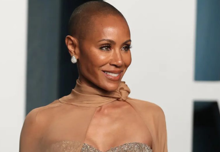 داء الثعلبة ..  شهيرات تحدّثن علناً عن معاناتهن من تساقط الشعر