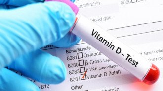 5 أعراض تنذرك بنقص خطير في فيتامين "د" ..  تعرف عليها