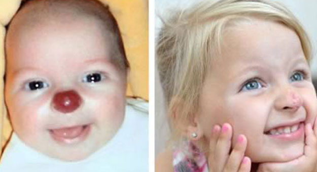 بالصور  ..  أغرب الوحمات على أجساد البشر والحيوانات