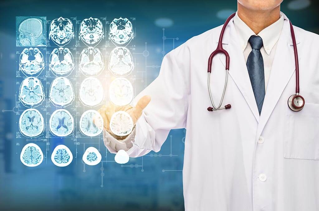 أخصائي أورام يوضح طرق الوقاية من أورام الدماغ