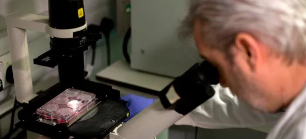 علماء يطورون اختبارا يمكن أن يساعد في اكتشاف علامات التصلب الجانبي قبل ظهور أعراض الإصابة به