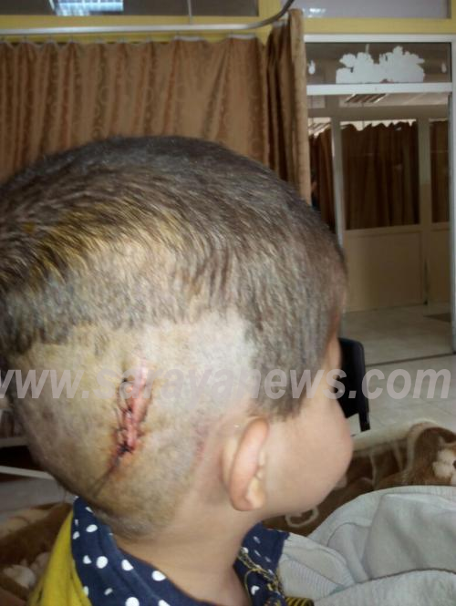 والدة الطفل "براء" الذي يعاني من شلل دماغي تناشد اهل الخير مساعدتها لأتمام علاجه  ..  "تفاصيل"