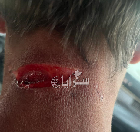 شاب يتعرض للطعن في رقبته خلال محاولة سلب في خريبة السوق  ..  والأمن يوقف الطرفين