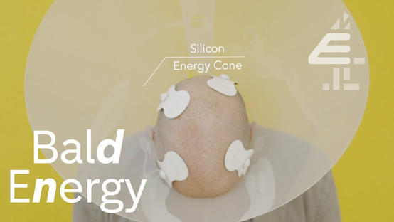 هل يمكن فعلا توليد الكهرباء من الرأس الأصلع؟