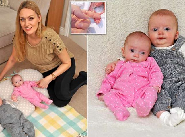معجزة طبية  ..  امرأة تضع طفلين توأم أحدهما يسبق الآخر بـ 3 أسابيع – صور