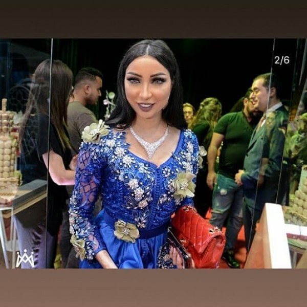 بالصور ..  من جديد دنيا بطمة بوجه "منفوخ" والجمهور "ارحمي وجهك سينفجر"