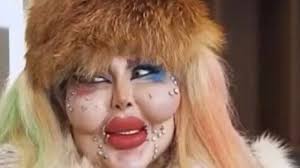 هوس التجميل ..  مؤثرة إيرانية تثير جدلاً بعد إعلانها خضوعها لـ388 عملية تجميل وبقائها 8 سنوات دون طعام 