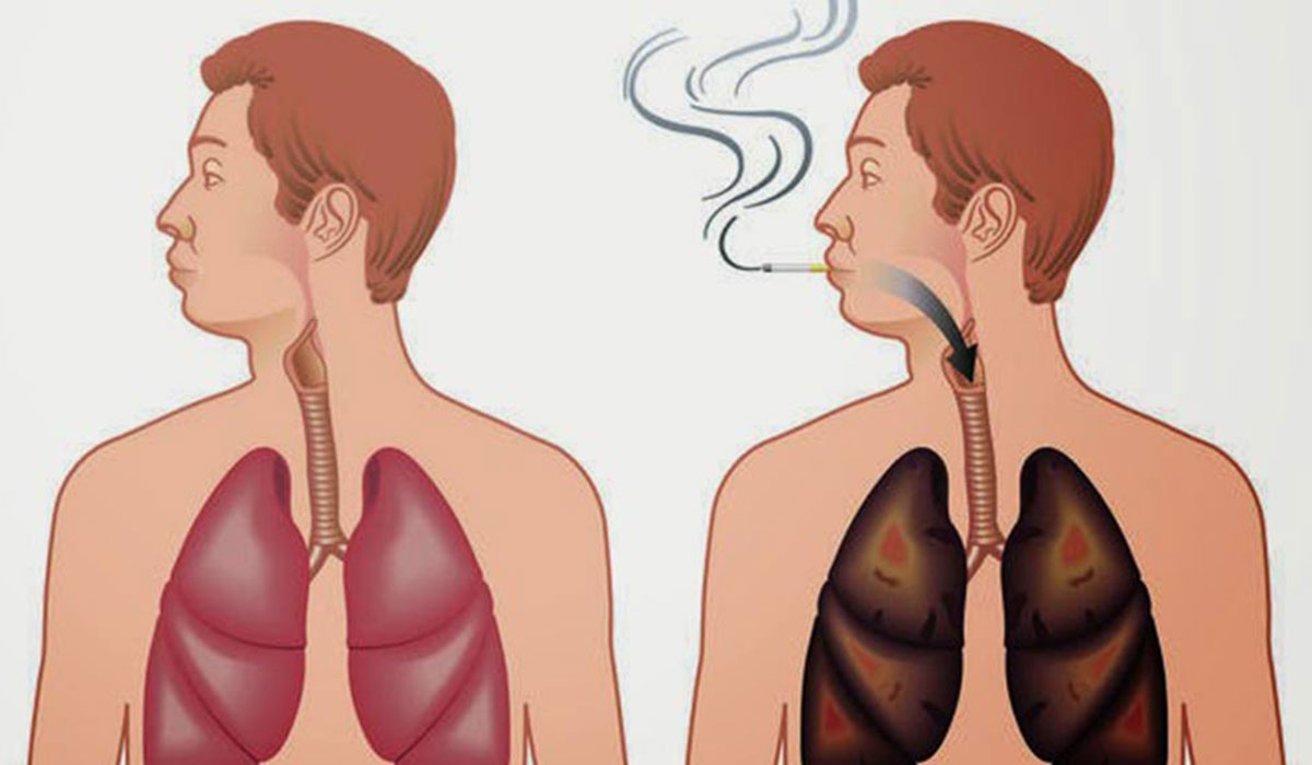 للمدخنين ..  اليكم طريقة لتنظيف الرئتين أولا بأول من آثار التدخين 