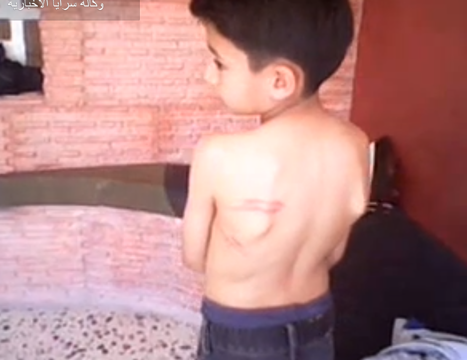 فيديو  .. يظهر معلم ضرب طفل بوحشية بـ"خرطوم مياه" في مدرسة بالرصيفة