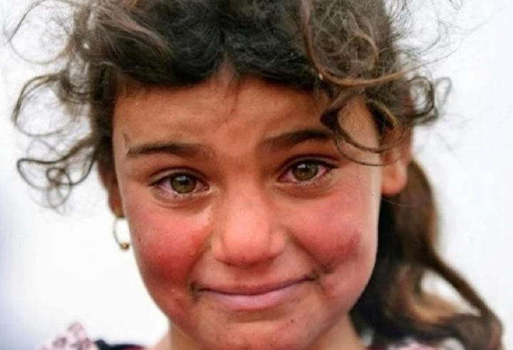 شاهدوا بالصور  ..  هل تتذكرون الطفلة صاحبة صورة الابتسامة الباكية؟ هكذا أصبح شكلها الآن