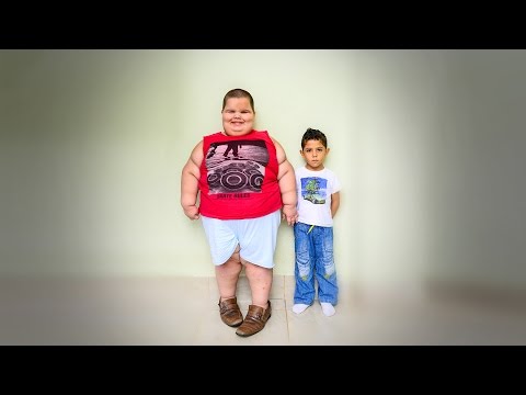 بالفيديو.. طفل عمره 5 سنوات وزنه 80 كجم