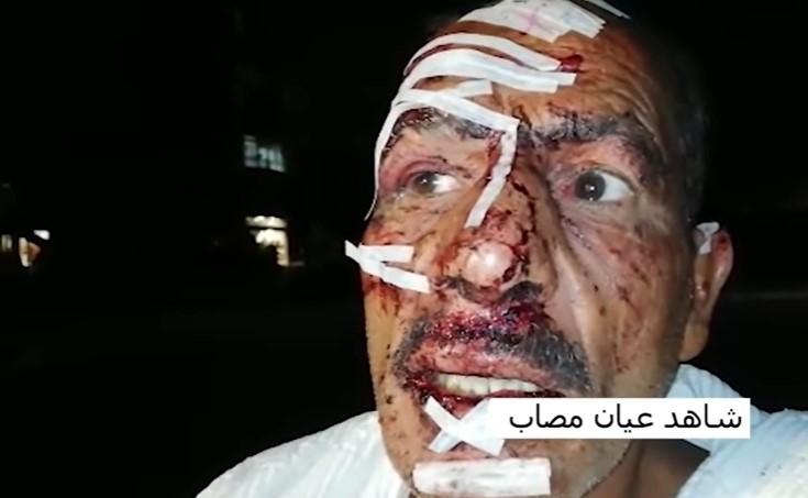 بالفيديو  ..  شاهد عيان مصاب يروي: "3 انفجارات دوّت بالمكان و هكذا فقدت الوعي"  ..  تفاصيل جديدة