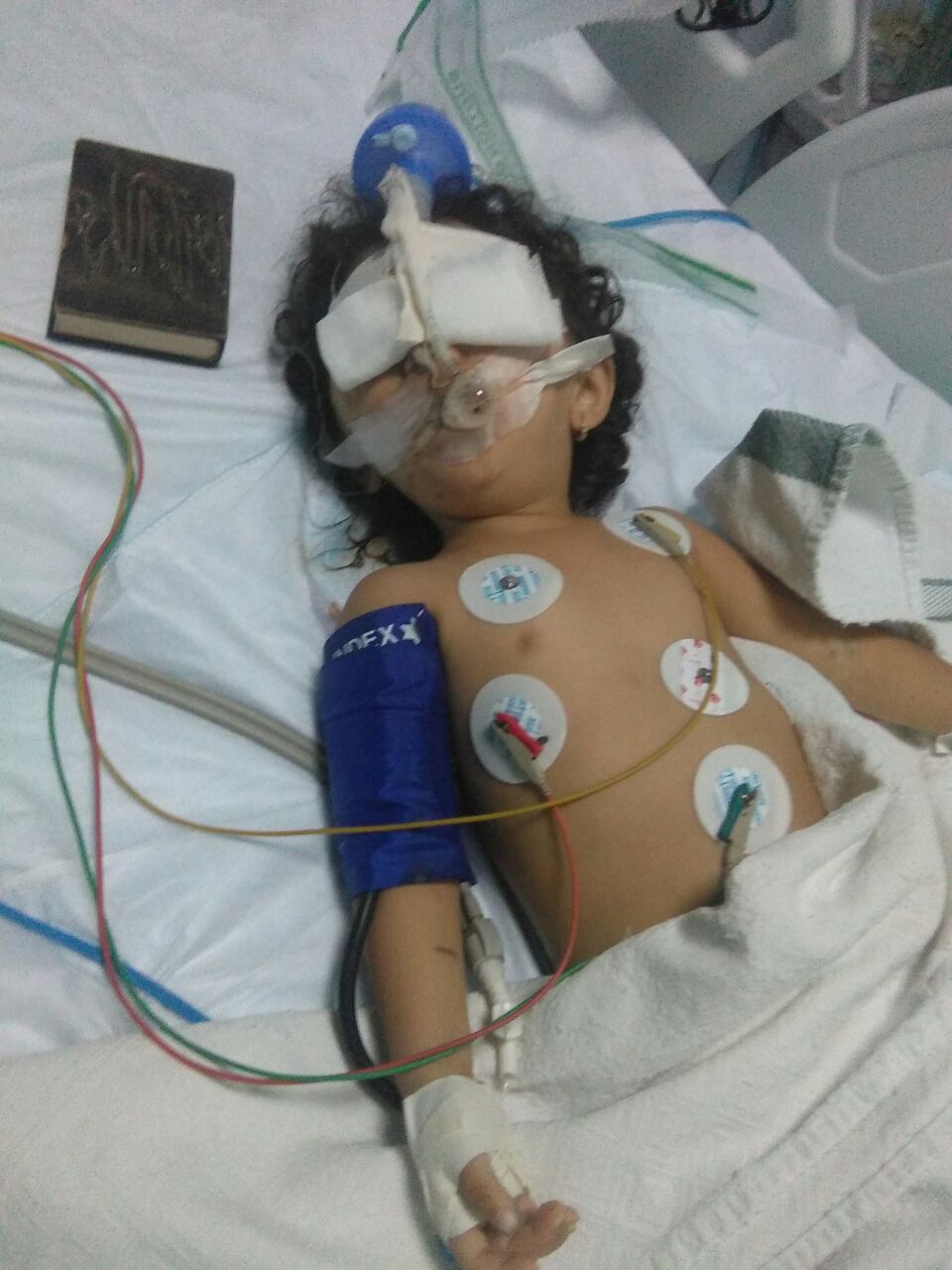 امام الملقي وقائد الجيش. طفلة تصارع الموت بعد سقوطها عن الطابق الثالث ..  ومطالبات بنقلها للمدينة الطبية